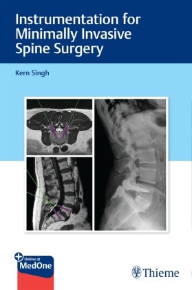 Instrumentation for Minimally Invasive Spine Surgery Singh Kern