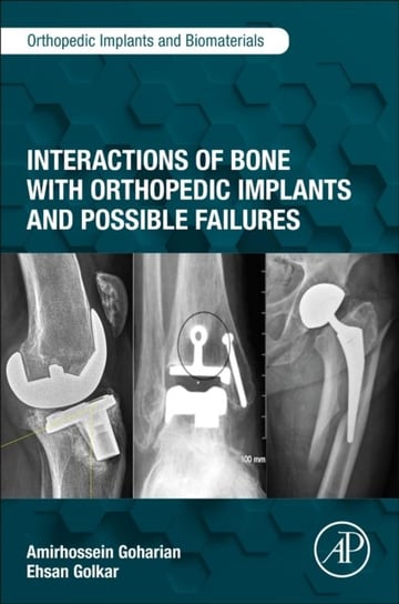 Interactions of Bone with Orthopedic Implants and Possible Failures Opracowanie zbiorowe