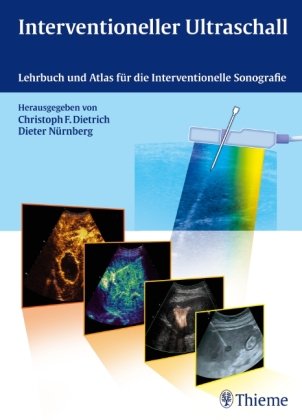 Interventioneller Ultraschall Thieme Georg Verlag, Thieme