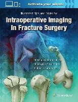 Intraoperative Imaging in Orthopaedic Trauma: Illustrated Tips and Tricks Gardner Michael J., Mamczak Christiaan N., Smith Christopher S.