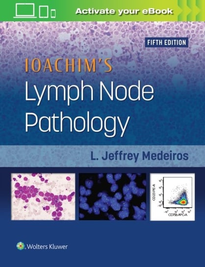 Ioachim's Lymph Node Pathology Medeiros Jeffrey L.