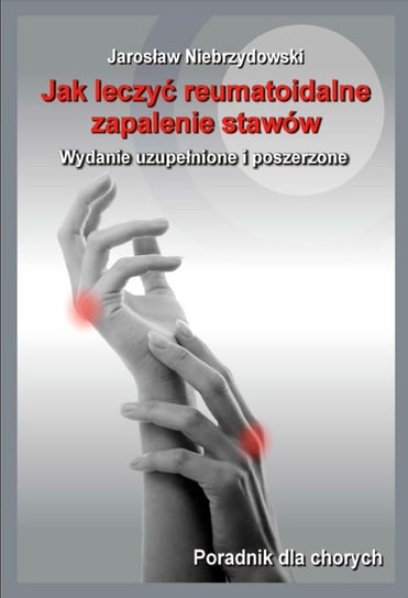 Jak leczyć reumatoidalne zapalenie stawów Niebrzydowski Jarosław