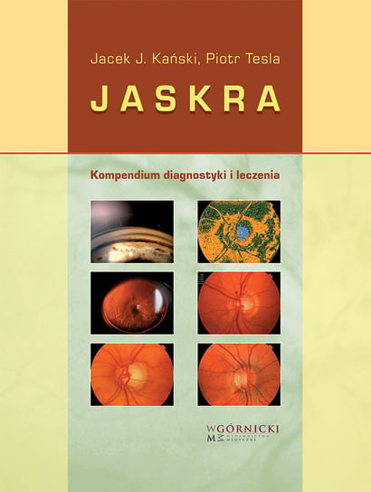 Jaskra. Kompendium diagnostyki i leczenia Kański Jacek J., Tesla Piotr