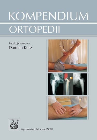 Kompendium ortopedii Kusz Damian