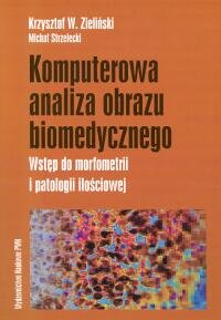 Komputerowa analiza obrazu biomedycznego Strzelecki Michał, Zieliński Krzysztof