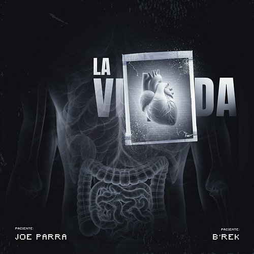 La Vida B'rek, Joe Parra