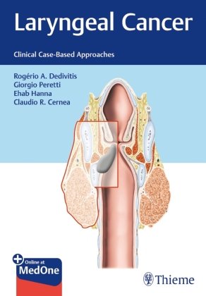 Laryngeal Cancer Dedivitis Rogerio, Hanna Ehab Y., Peretti Giorgio, Cernea Claudio Roberto