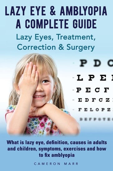 Lazy Eye & Amblyopia. Lazy eyes, treatment, correction and surgery. What is lazy eye, definition, causes in adults and children, symptoms, exercises. A complete guide. Marr Cameron