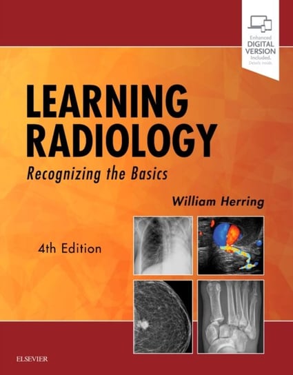 Learning Radiology: Recognizing the Basics William Herring