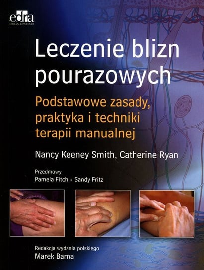 Leczenie blizn pourazowych Keeney Smith Nancy, Ryan Cathy