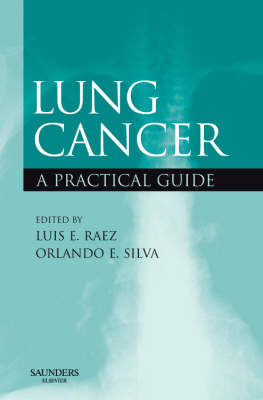 Lung Cancer Raez Luis