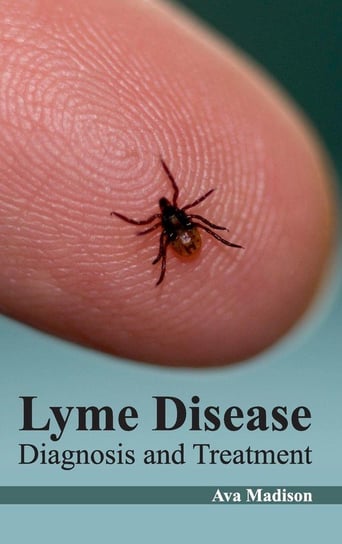 Lyme Disease M L Books International Pvt Ltd