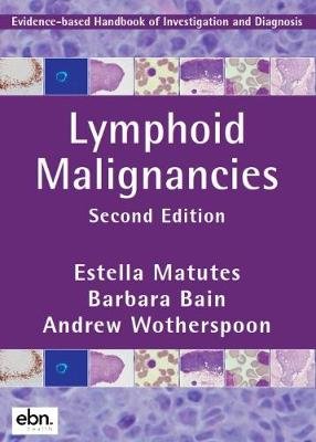 Lymphoid Malignancies: Evidence-based Handbook of Investigation and Diagnosis Estella Matutes
