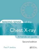 Making Sense of the Chest X-Ray, Second Edition: A Hands-On Guide Jenkins Paul, Jenkins Paul F.