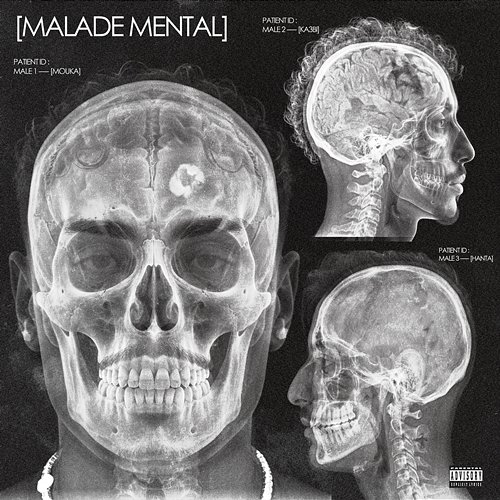Malade Mental Mouka, ka3bi, Hanta