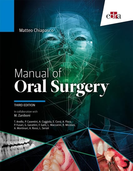 Manual of Oral Surgery Matteo Chiapasco