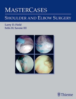 Master Cases, Shoulder and Elbow Surgery Thieme, Stuttgart