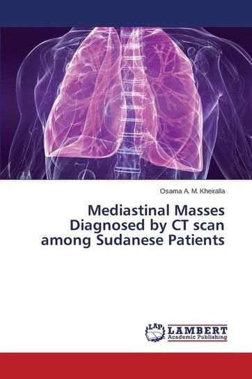 Mediastinal Masses Diagnosed by CT scan among Sudanese Patients Kheiralla Osama A. M.