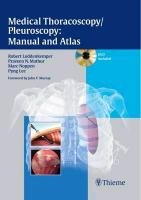 Medical Thoracoscopy / Pleuroscopy: Manual and Atlas Loddenkemper Robert, Mathur Praveen N., Noppen Marc, Lee Pyng