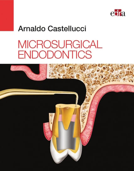 Microsurgical Endodontics - ebook epub Arnaldo Castellucci