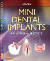 Mini Dental Implants Sendax Victor