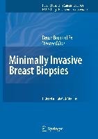 Minimally Invasive Breast Biopsies Springer-Verlag Gmbh, Springer Berlin