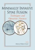 Minimally Invasive Spine Fusio Thieme Medical Publ Inc., Thieme Medical Publishers Inc.