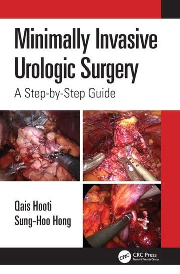 Minimally Invasive Urologic Surgery: A Step-by-Step Guide Qais Hooti