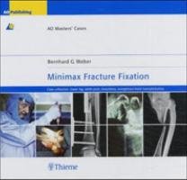 Minimax Fracture Fixation Weber Bernhard G.