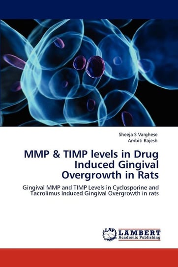 Mmp & Timp Levels in Drug Induced Gingival Overgrowth in Rats Varghese Sheeja S.