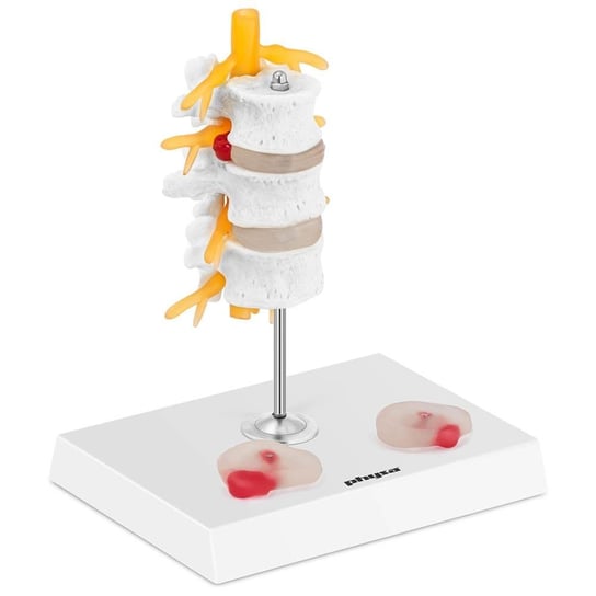 Model anatomiczny 3D odcinka lędźwiowego kręgosłupa z przepukliną kręgi 3-5 UPOMINKARNIA