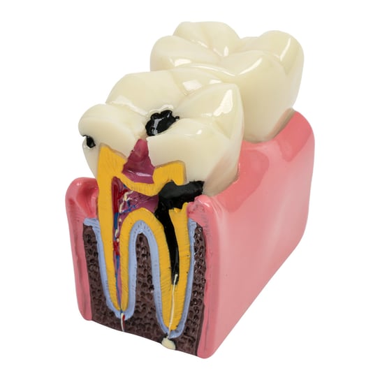 Model Choroby Zębów Inna marka