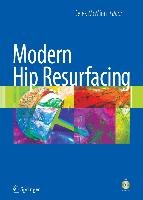 Modern Hip Resurfacing [With DVD] Springer Nature, Springer London