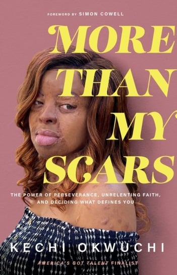 More Than My Scars - The Power of Perseverance, Unrelenting Faith, and Deciding What Defines You Kechi Okwuchi