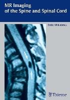 MR  Imaging of the Spine and Spinal Cord Uhlenbrock Detlev