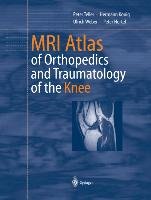 MRI Atlas of Orthopedics and Traumatology of the Knee Hertel Peter, Konig Hermann, Teller Peter, Weber Ulrich