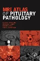 MRI Atlas of Pituitary Pathology Hamrahian Amir H., Pantalone Kevin M., Jones Stephen E., Weil Robert J.