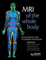 MRI Of The Whole Body: An Illustrated Guide To Common Pathologies Bhuskute Nikhil, Hoey Edward, Lakkaraju Amit, Mankad Kshitij