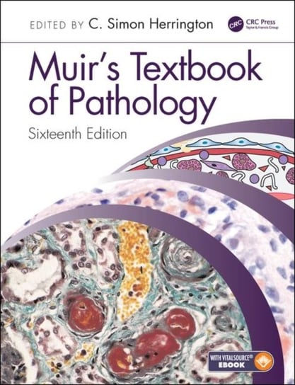 Muirs Textbook of Pathology Opracowanie zbiorowe