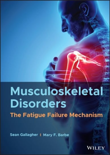 Musculoskeletal Disorders: The Fatigue Failure Mechanism S. Gallagher