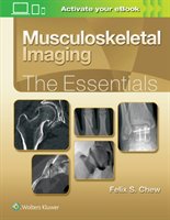 Musculoskeletal Imaging: The Essentials Chew Felix S.