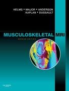 Musculoskeletal MRI Helms Clyde A., Major Nancy M., Anderson Mark W., Kaplan Phoebe, Dussault Robert
