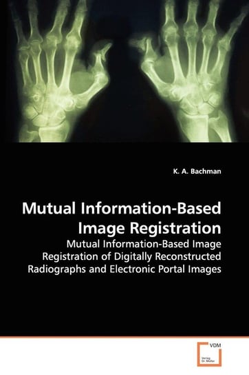 Mutual Information-Based Image Registration Bachman K. A.
