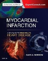 Myocardial Infarction: A Companion to Braunwald's Heart Dise Morrow David
