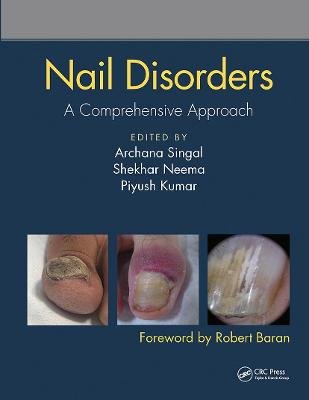 Nail Disorders: A Comprehensive Approach Taylor & Francis Ltd.