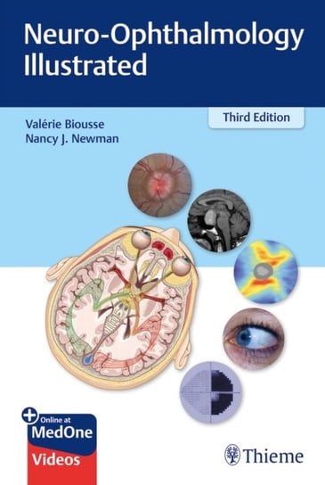 Neuro-Ophthalmology Illustrated Valerie Biousse, Nancy Newman