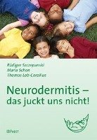 Neurodermitis - das juckt uns nicht! Szczepanski Rudiger, Schon Maria, Lob-Corzilius Thomas