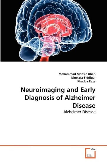 Neuroimaging and Early Diagnosis of Alzheimer Disease Mohsin Khan Mohammad