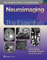 Neuroimaging: The Essentials Sanelli Pina