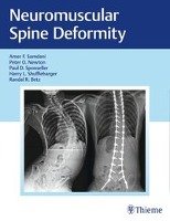 Neuromuscular Spine Deformity Thieme Georg Verlag, Thieme Medical Publishers Inc.